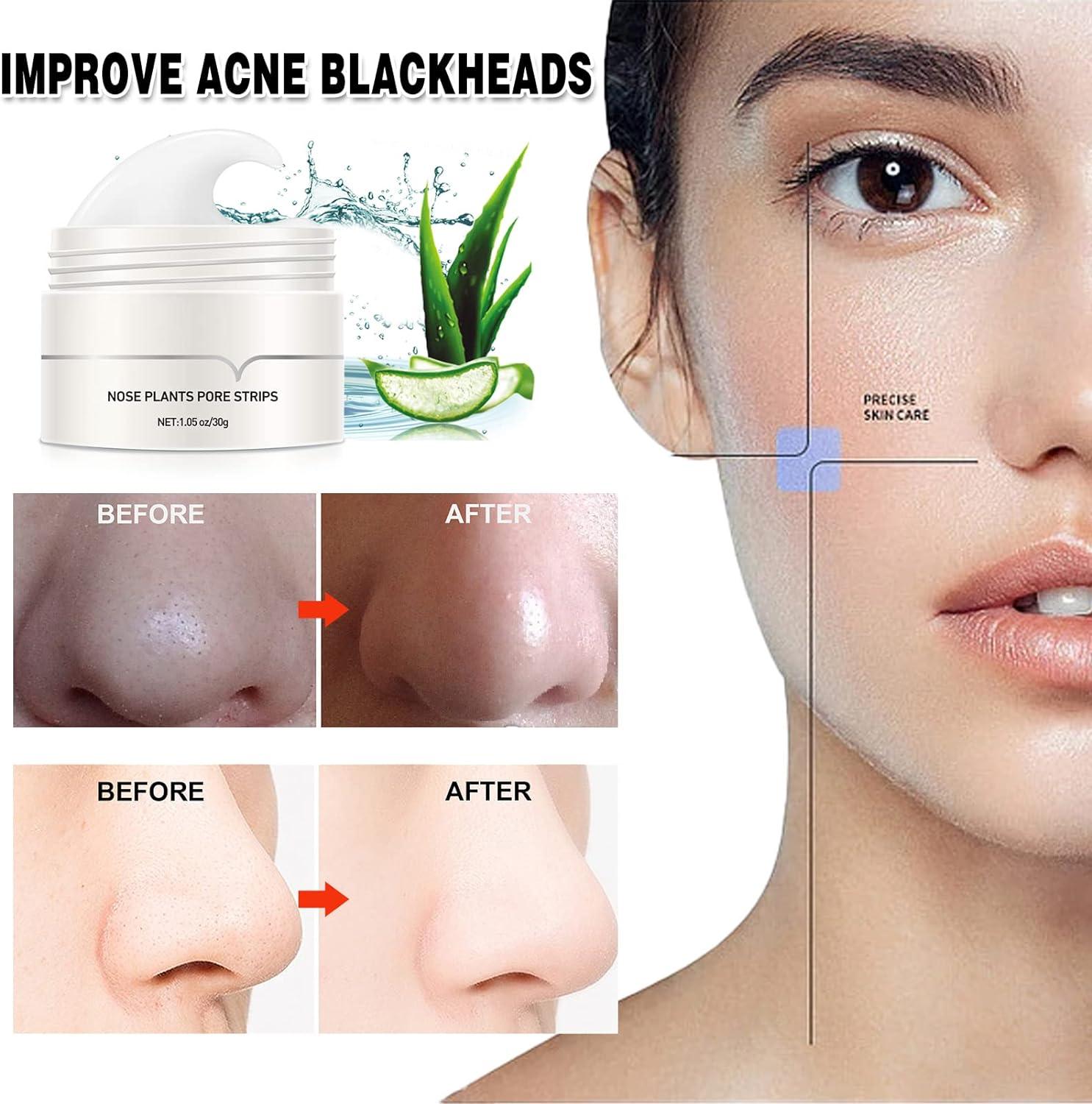 Blackhead Mask & Serum Set